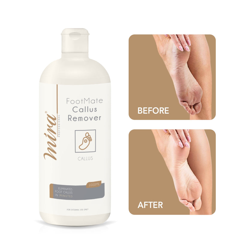 Mira Callus Remover with Double-sided Wood Foot File - Albasel cosmetics